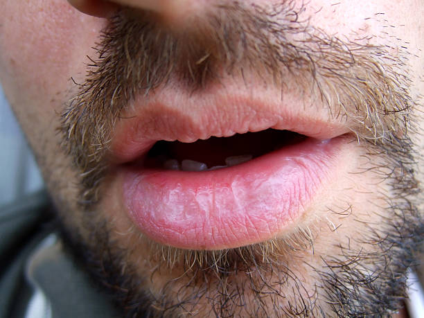 Perfil de Edison
